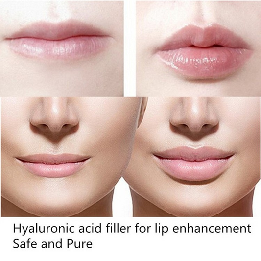 Hyaluronic Acid Descr