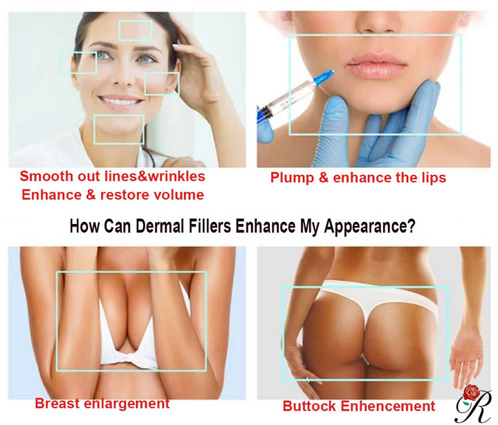 Butt Enlargement Cross Linked Hyaluronic Acid Buttock Breast Enhancement Subskin dermal filler injections  