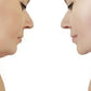 Lipo Lab PPC Solution – Fat Dissolving Injection for Face & Body Slimming