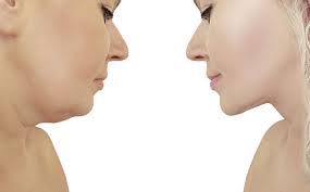 Lipo Lab PPC Solution – Fat Dissolving Injection for Face & Body Slimming